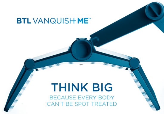 vanquish-think-big